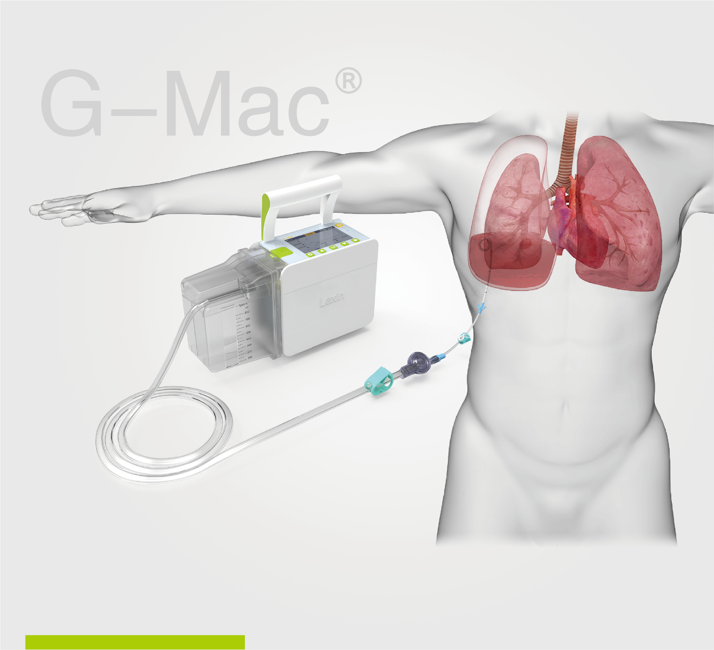 【火热招商】乐信数字化医疗器械(线上)展——第二期·胸腔引流监控系统 G-Mac?